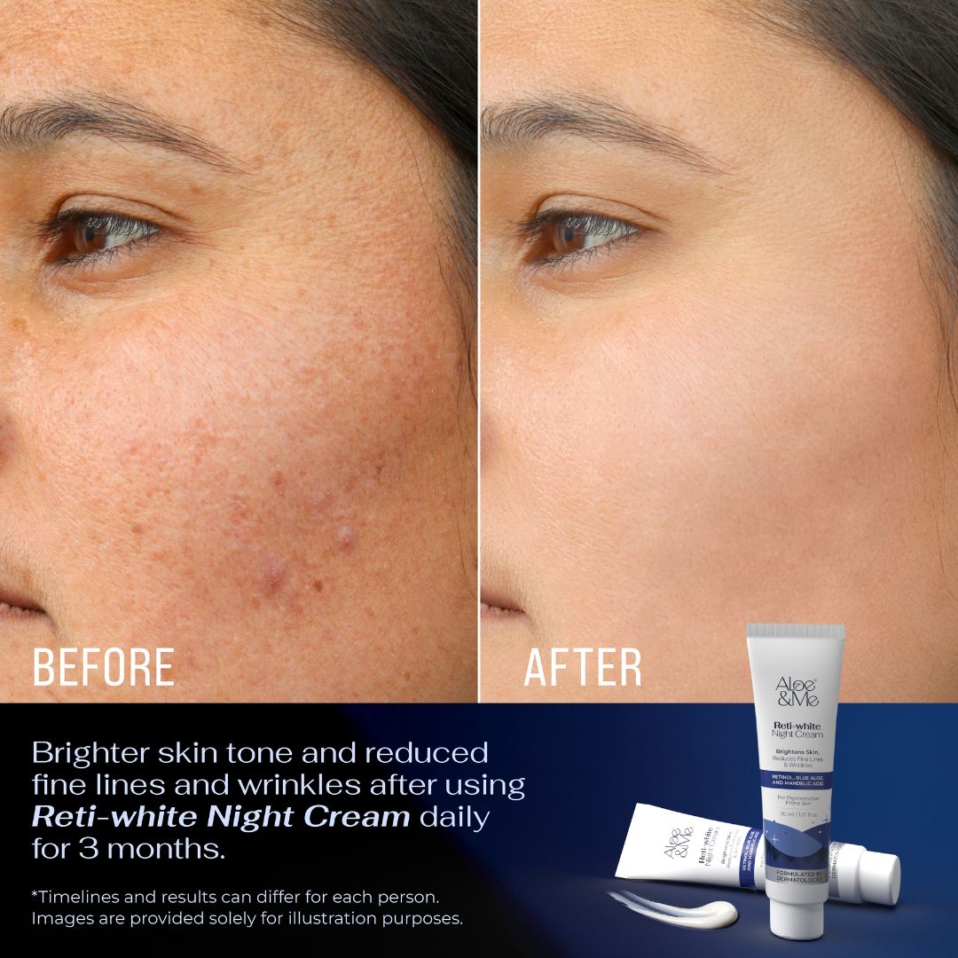 Reti-White Night Cream