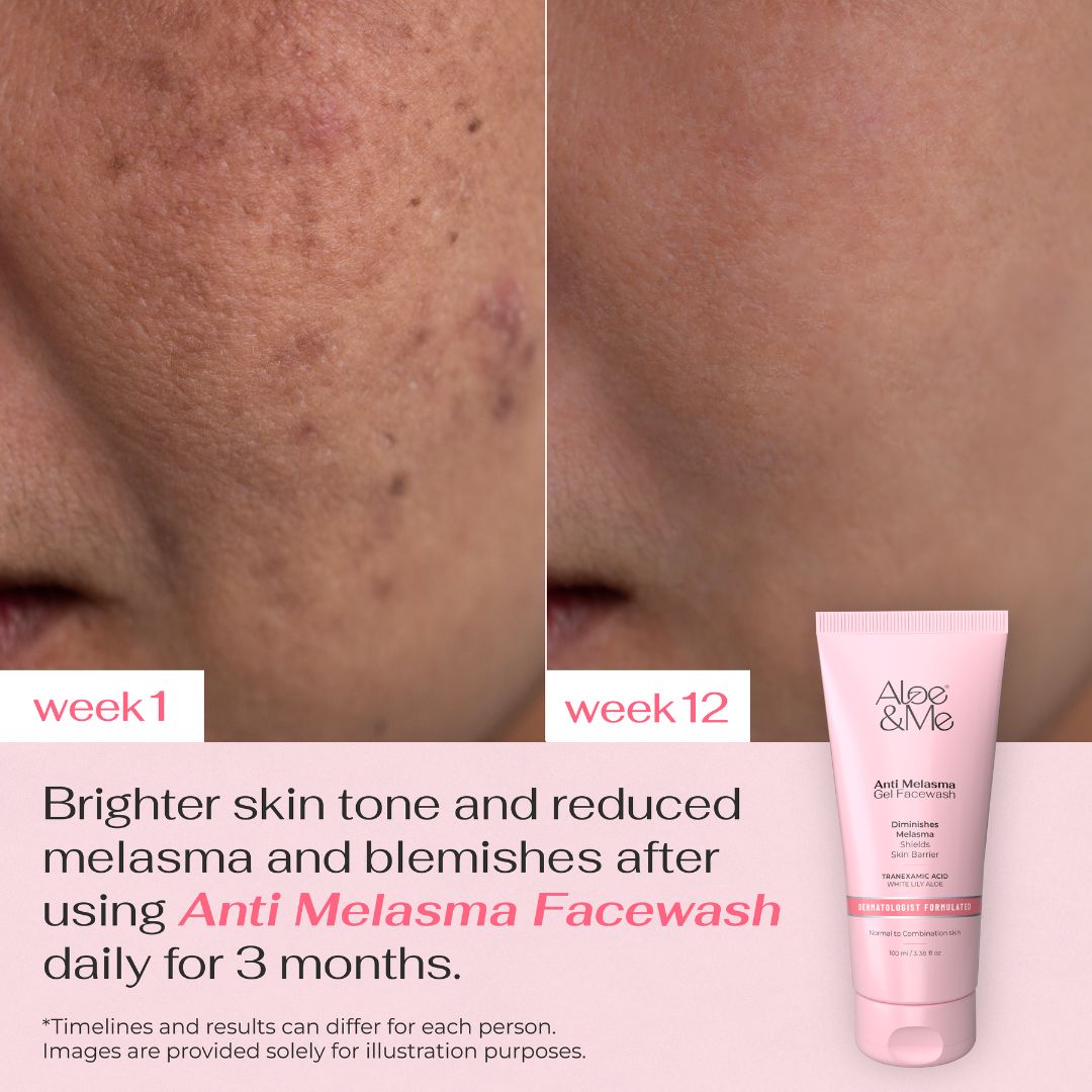Anti Melasma Gel Facewash