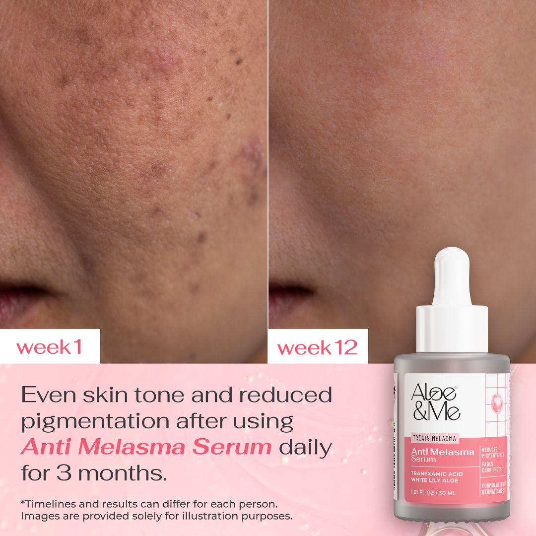 Anti Melasma Serum