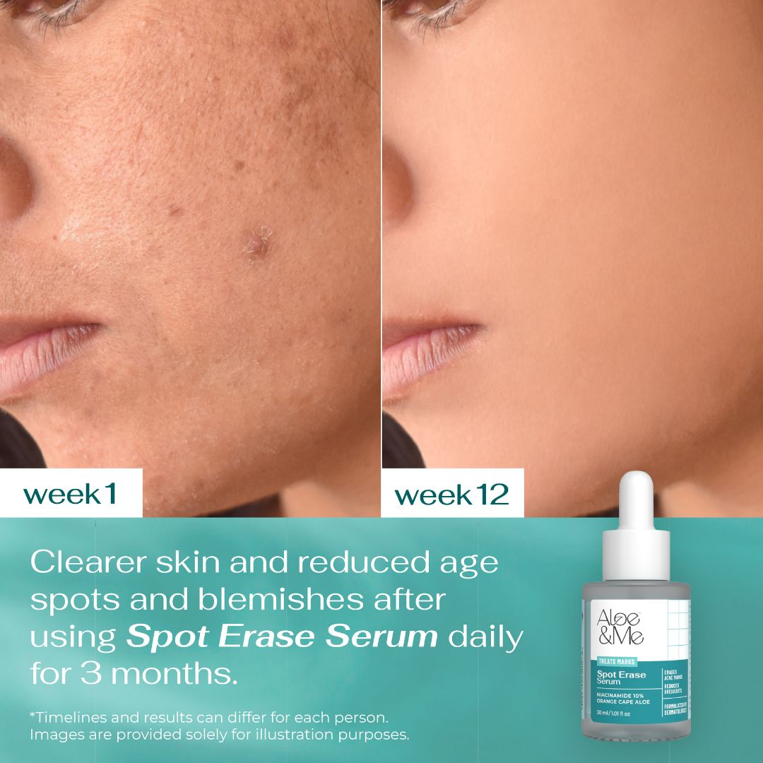 Spot Erase Serum