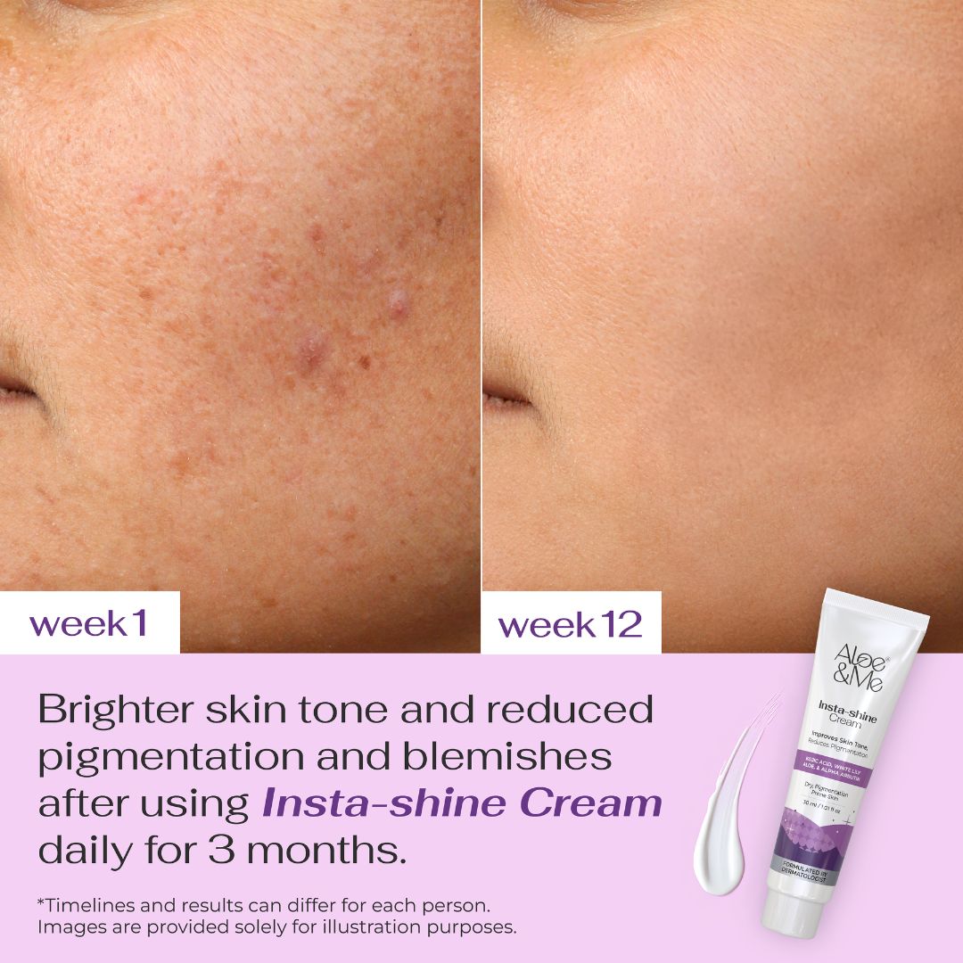 Insta-Shine Night Cream