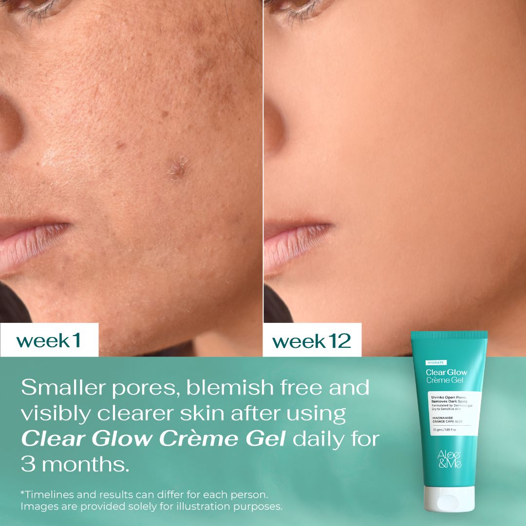 Clear Glow Creme Gel