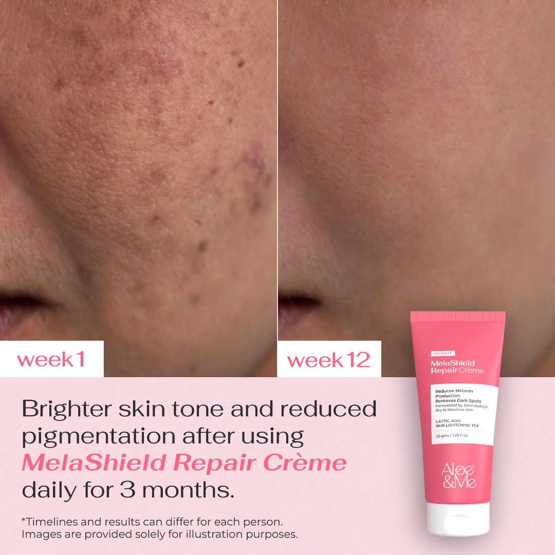 MelaShield Repair Creme