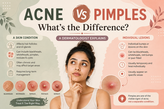 Acne vs Pimples: What's the Difference?