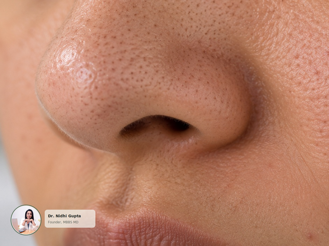 How to Get Rid of Blackheads: A Dermatologist's Guide