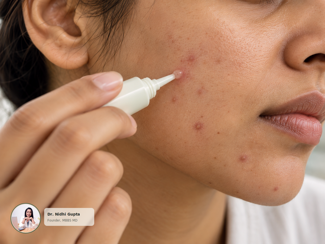 How to Get Rid of Pimples Fast: What Actually Works