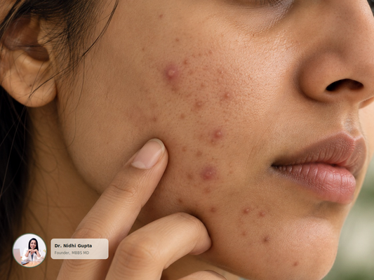 What Causes Acne? 7 Common Causes Explained by a Dermatologist