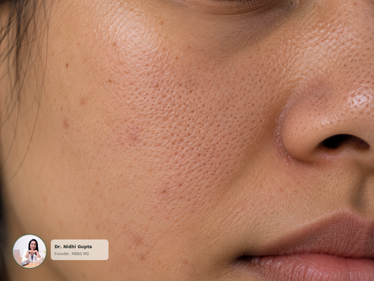 Whiteheads vs Blackheads: What's the Difference?