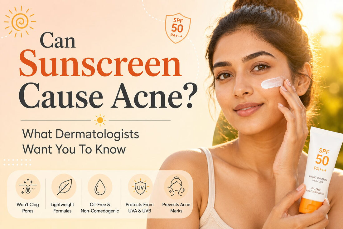 Can sunscreen cause acne cover image showing a young Indian woman with sunscreen and dermatologist-approved tips for acne-prone skin.