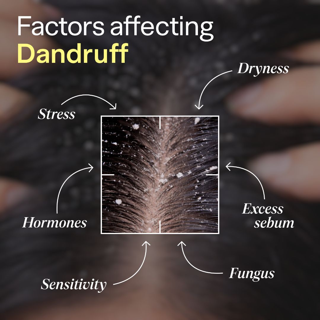 ScalpClear Anti Dandruff Shampoo