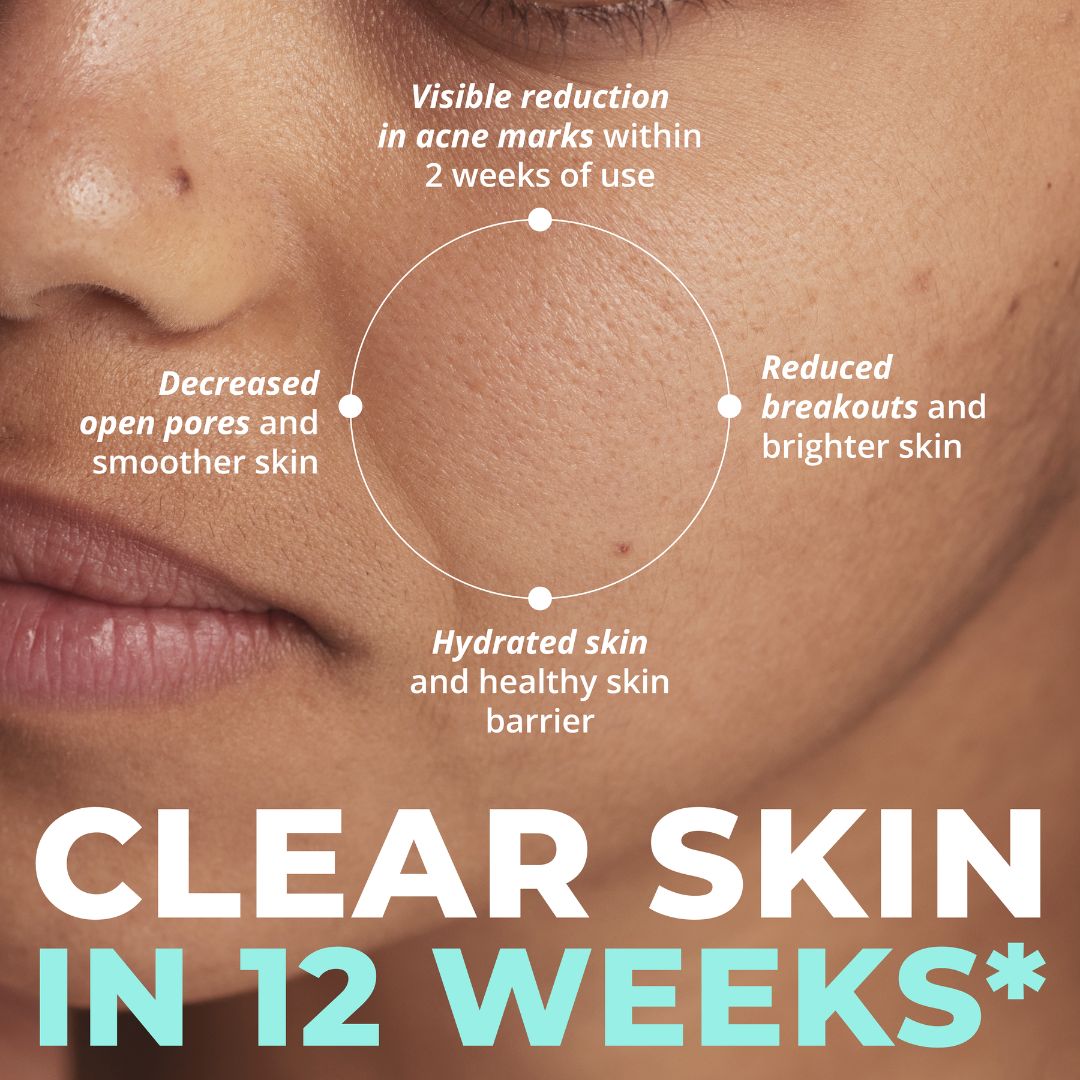 4-Step Pigment Clear Kit