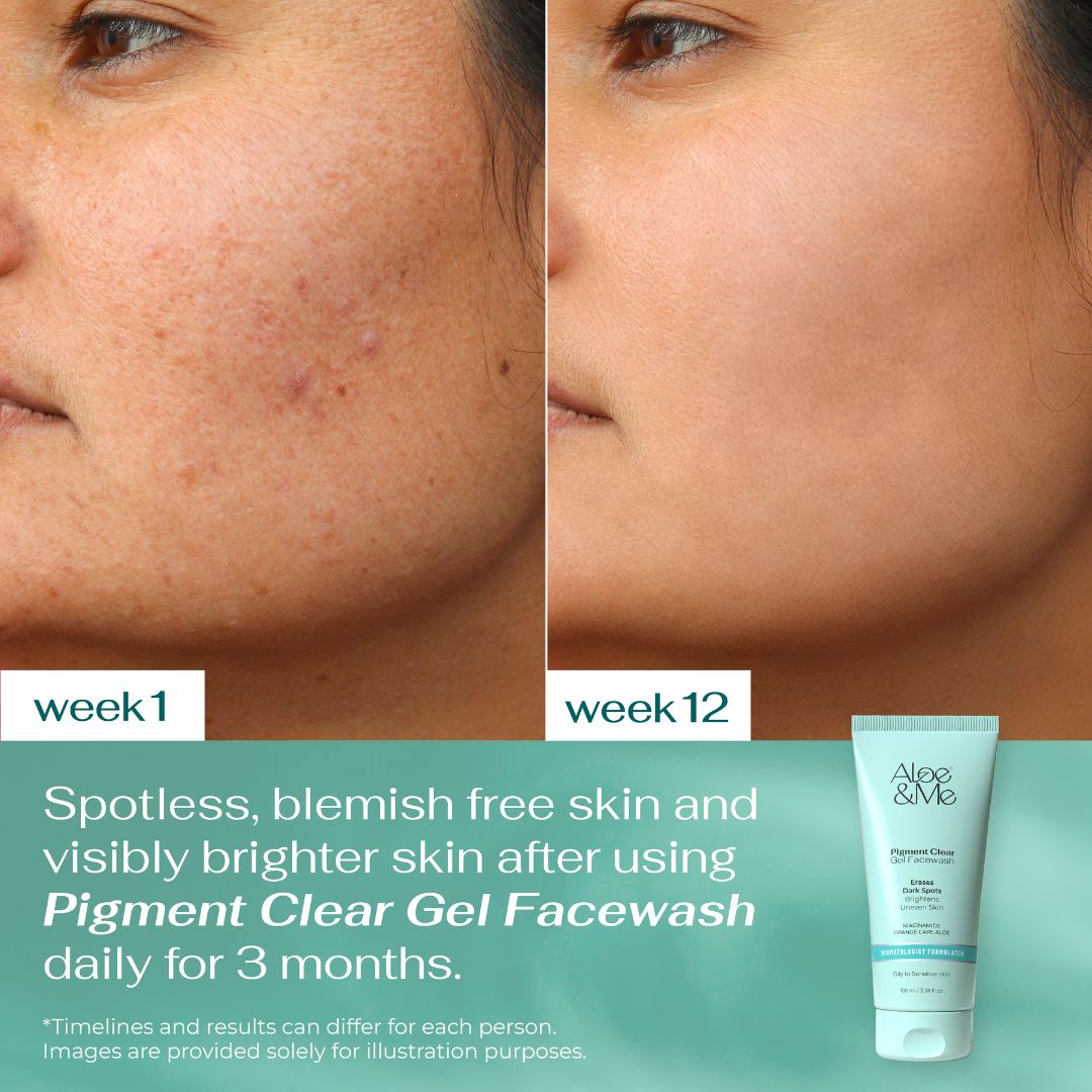 Pigment Clear Gel Facewash
