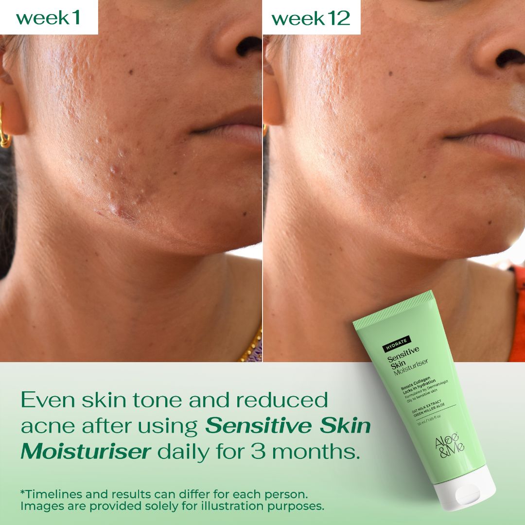 Moisturiser for Sensitive Skin