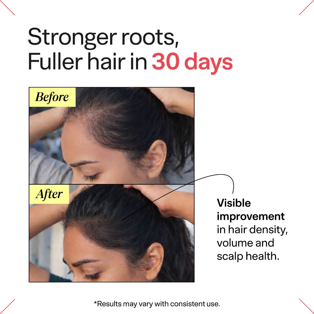 Root Serum for Hair growth