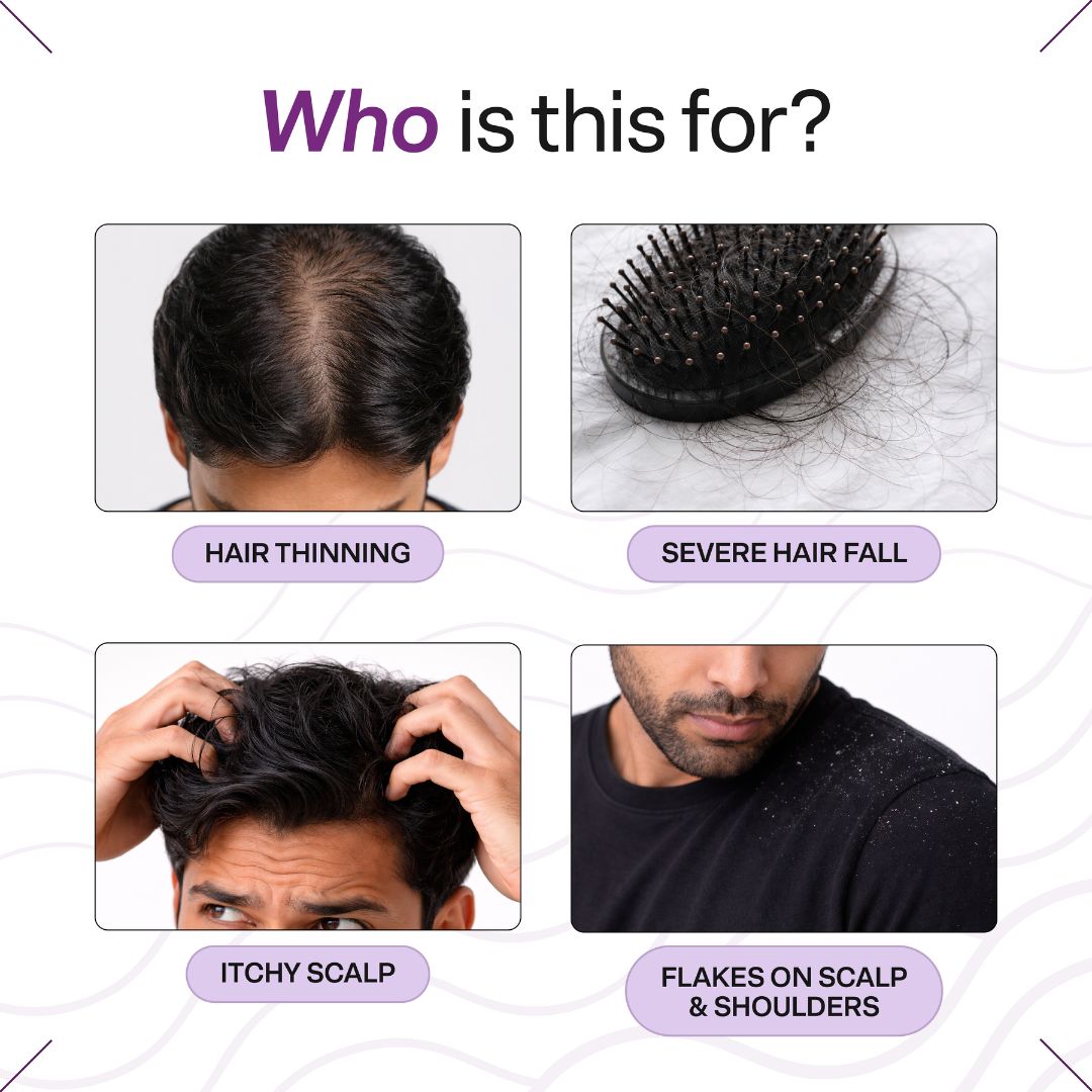 Oil Control Hairfall Kit for Oily Scalp | Hair Fall Treatment Routine