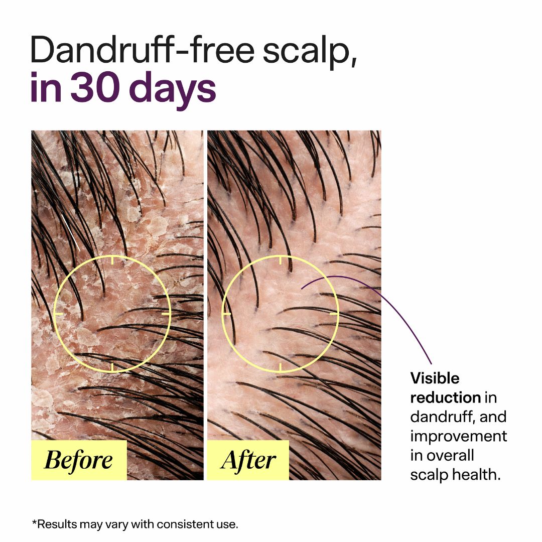 ScalpClear Anti Dandruff Shampoo