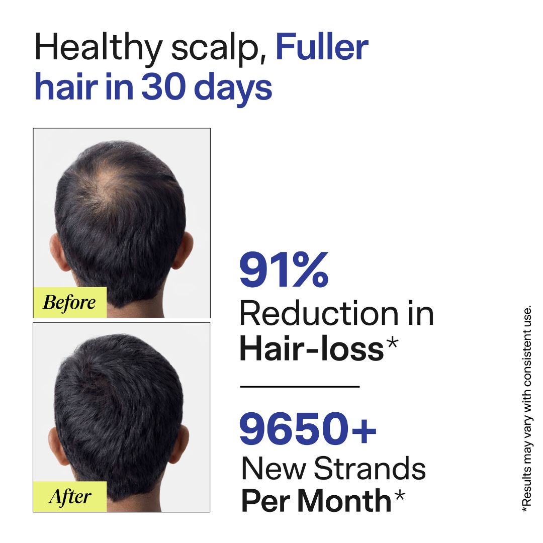 HairFuel Hair Growth Nutraceutical