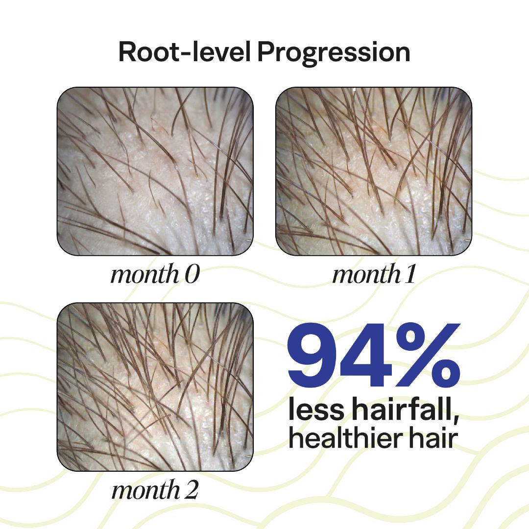 HairFuel Hair Growth Nutraceutical