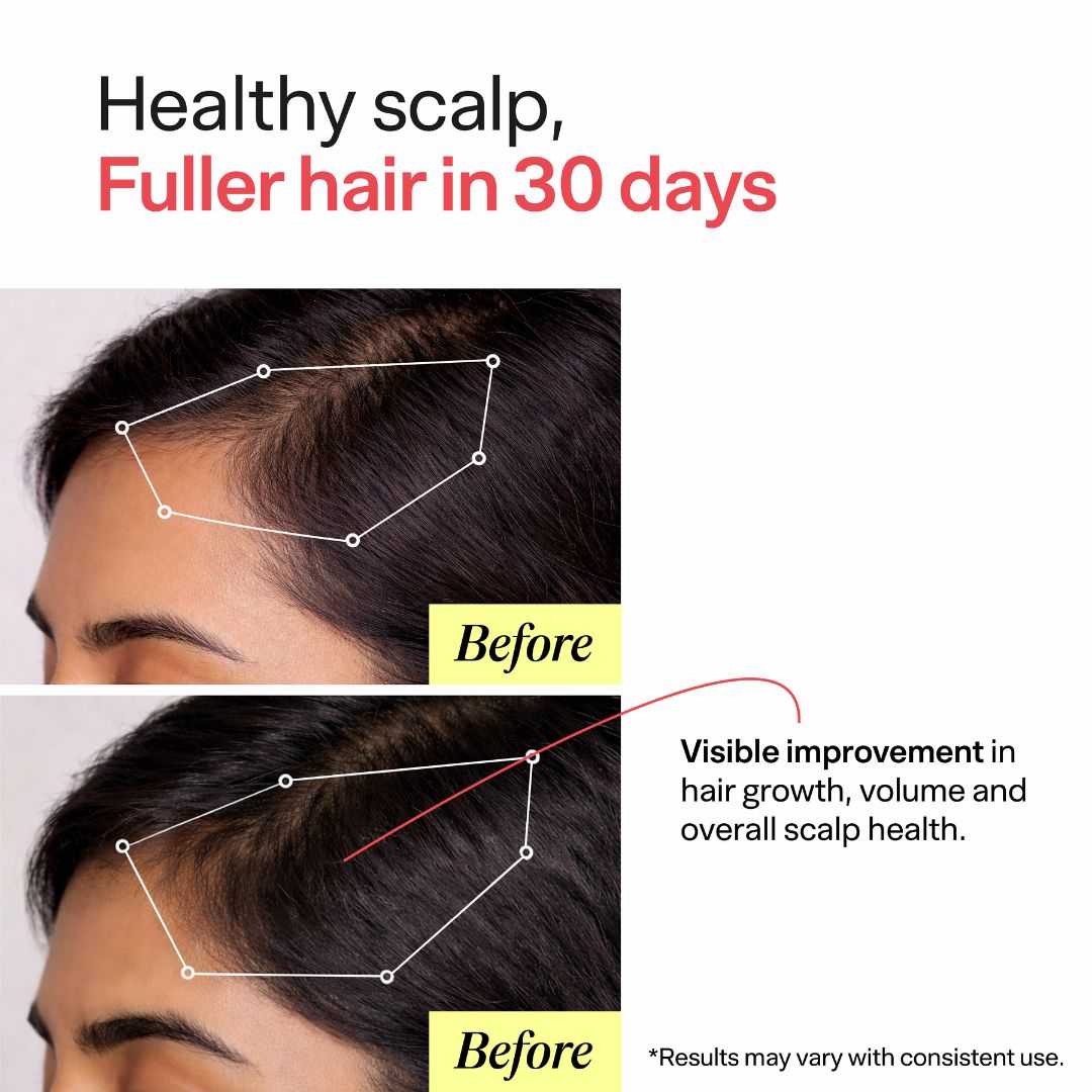 HairGain Shampoo for Hair growth