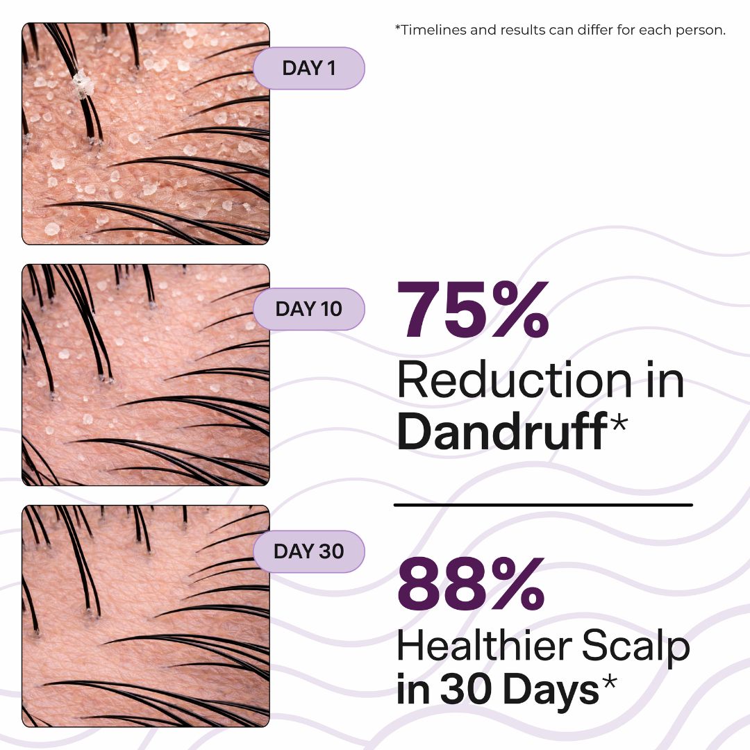 ScalpClear Anti Dandruff Shampoo