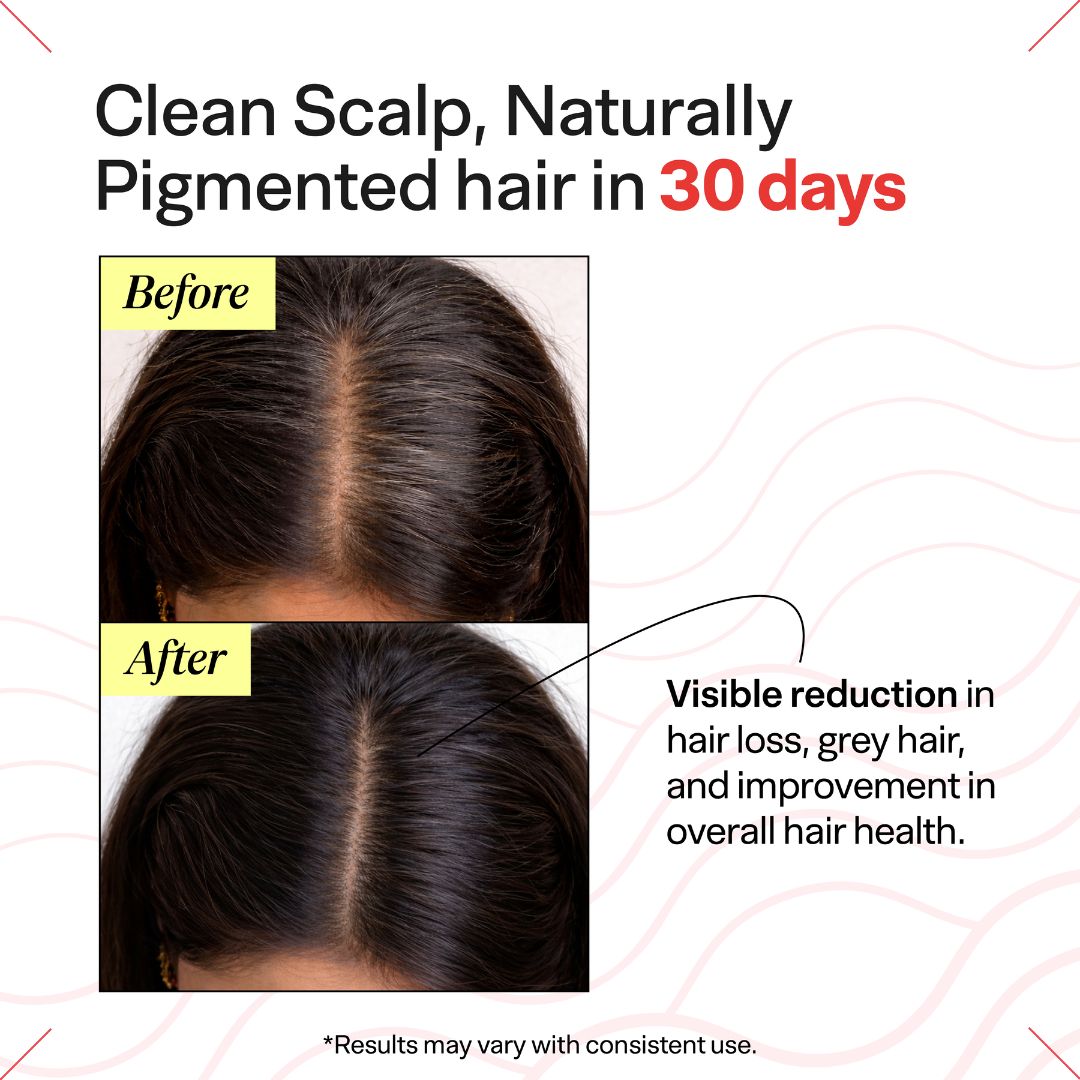 Advanced Daily Anti-Grey Kit with Black Serum & Hairfuel | Complete Premature Greying Care System