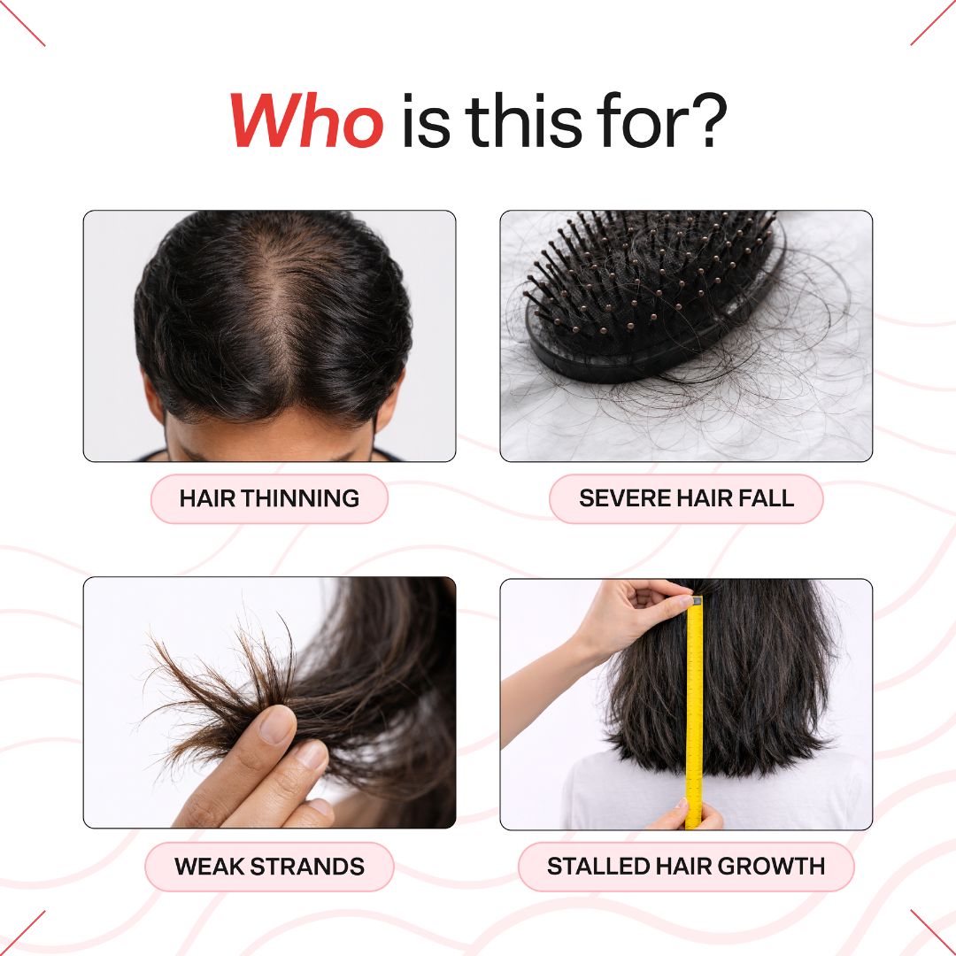 Advanced Daily Hairfall Kit with Hairfuel | Complete Hair Fall Treatment System