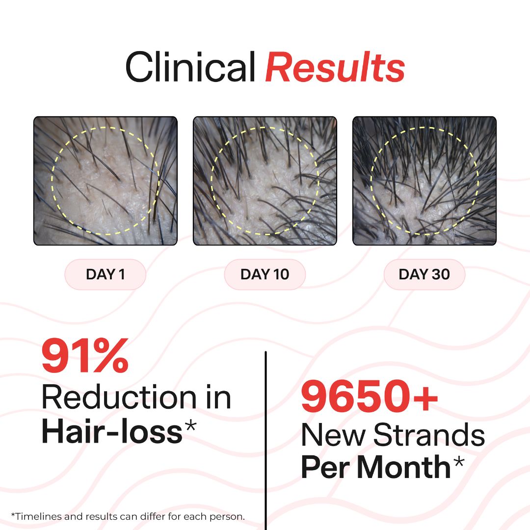 Root Serum for Hair growth