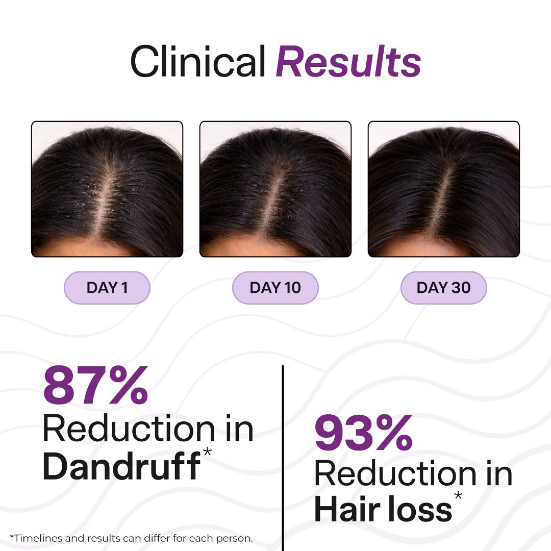 Oil Control Hairfall Kit for Oily Scalp | Hair Fall Treatment Routine