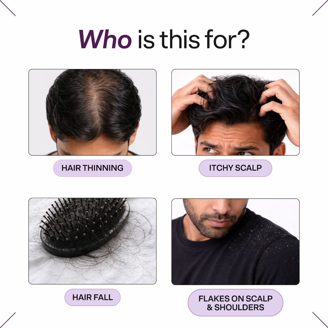 ScalpClear Anti Dandruff Shampoo