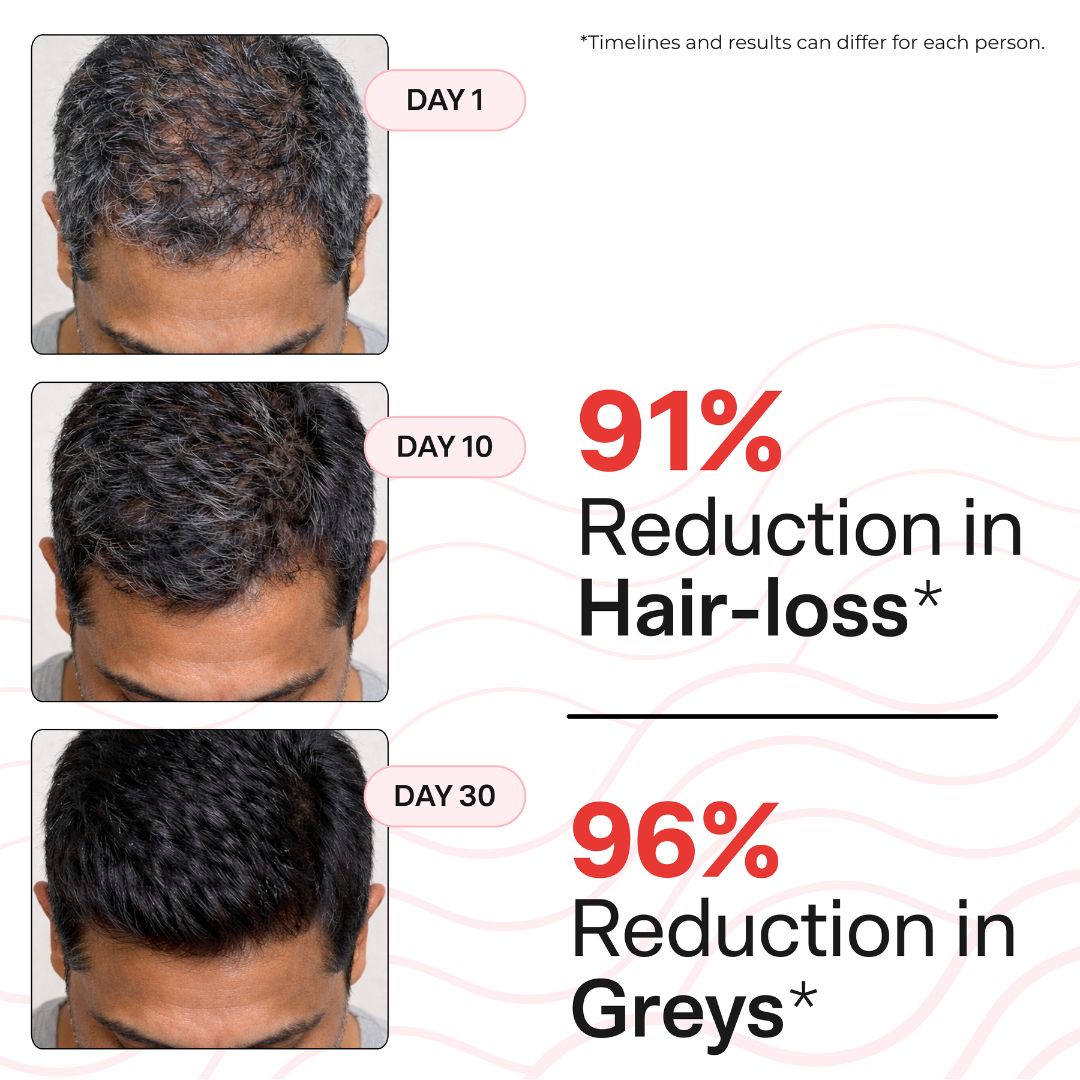 Advanced Daily Anti-Grey Kit with Black Serum & Hairfuel | Complete Premature Greying Care System