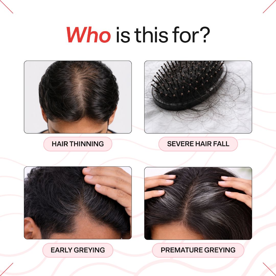 Advanced Daily Anti-Grey Kit with Black Serum & Hairfuel | Complete Premature Greying Care System