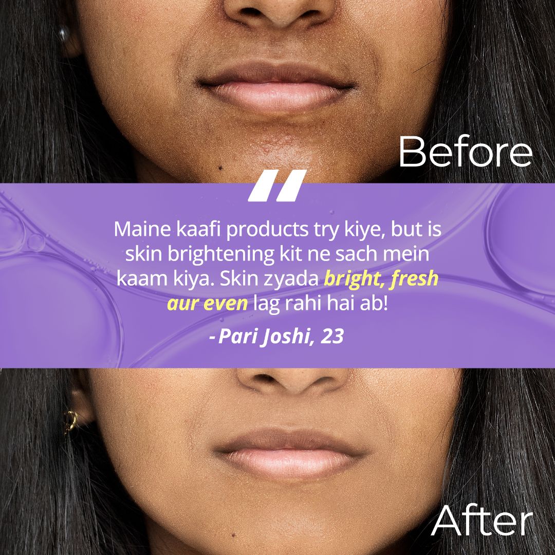 Advanced Skin Brightening Kit