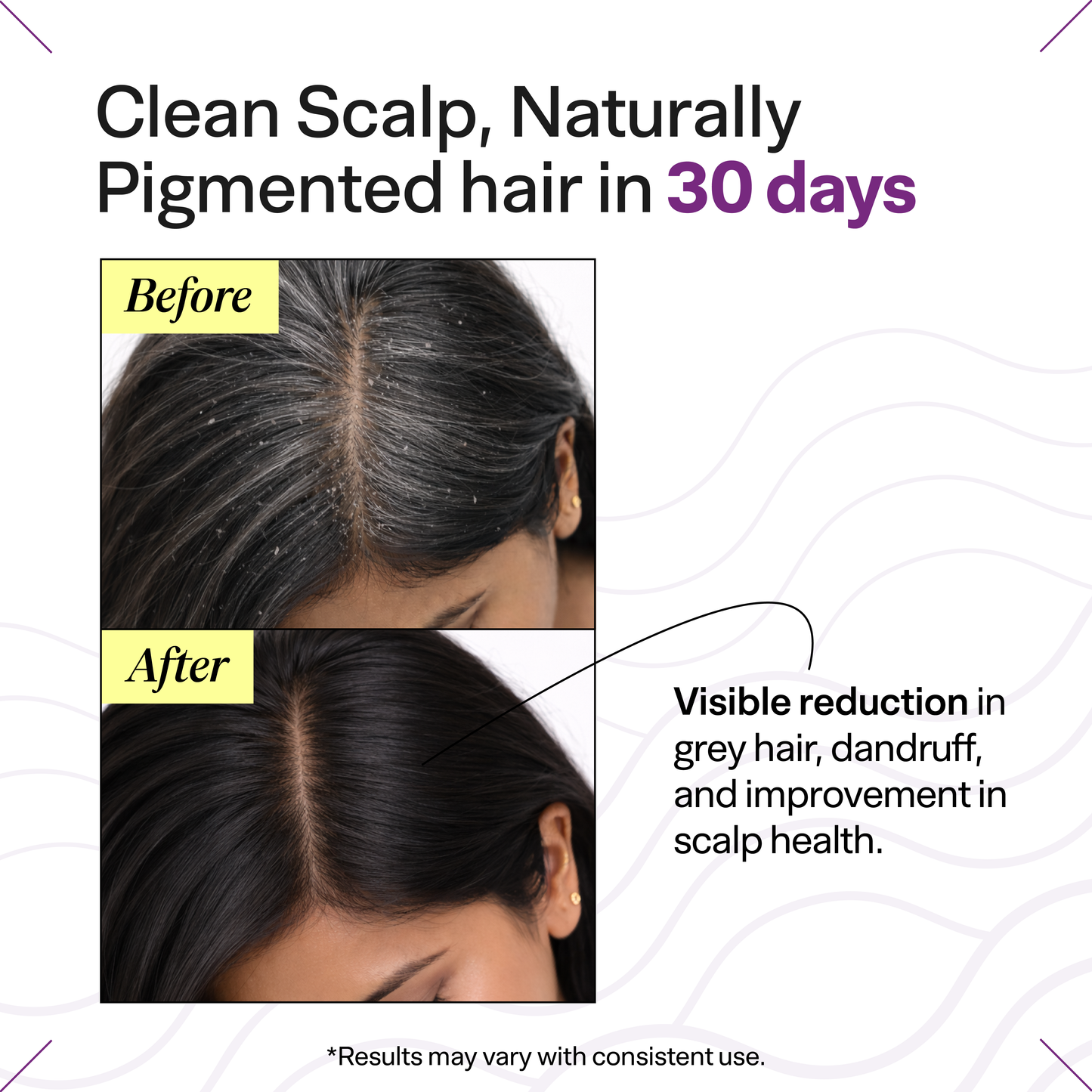 Oil Control Anti-Grey Hair Kit with Black Serum | Oily Scalp Premature Greying Care